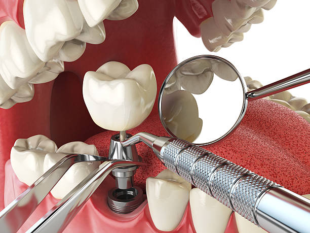 Best Root Canal Emergency Dentist  in Chevy Chase Village, MD
